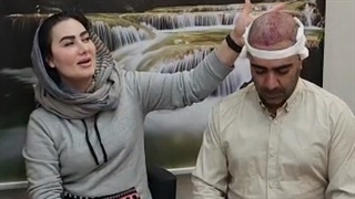 باتراکم بالا بدون جراحی بخیه