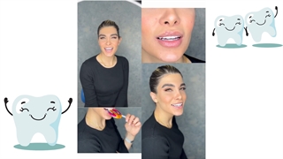 لمینت سرامیکی ایمکس