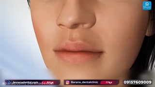 آیا لیفت لثه با لیزر درد دارد؟