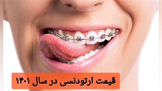 قیمت ارتودنسی در سال ۱۴۰۱