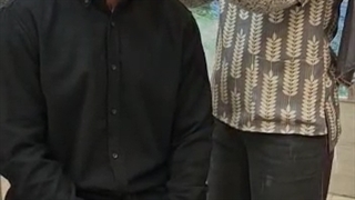 بعد از کاشت مو