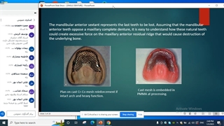 بی دندانی - دکتر مجیدی
