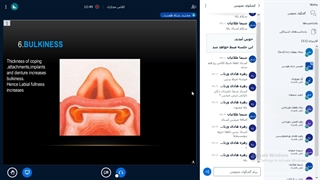 بی دندانی - دکتر صالحی پوسیدگی دندان