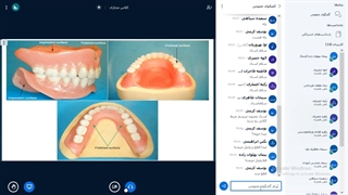 بی دندانی - دکتر صفاریان پور