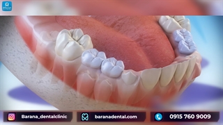 نحوه درآمدن دندان شیری به چه صورت است؟