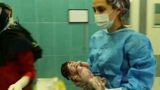 زایمان سزارین