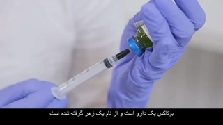 تاثیر بوتاکس برای پیشانی