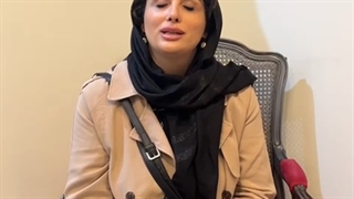 کاشت ابرو