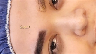 کاشت ابرو