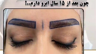 بعد از 15 سال دوباره ابرو دارم..!