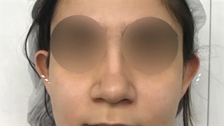 جراحی زیبایی گوش