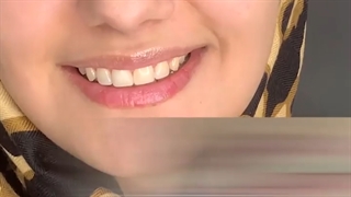 لبخند زیبا حق شماست...