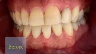 یک جلسه بلیچینگ افیس