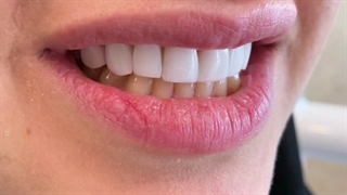 16واحد ونیر کامپوزیت