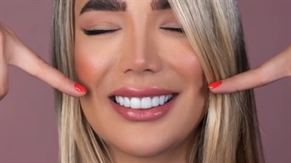 هشت واحد لمینت سرامیکی