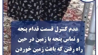 ارتوز afo