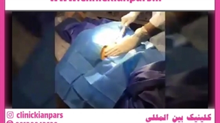 آیا سحر قریشی هم تزریق چربی انجام داده؟ برداشتن زگیل