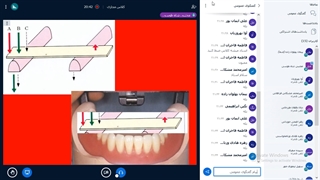 بی دندانی - دکتر دارابی