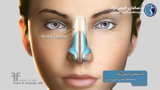 بعد از رینوپلاستی میتونیم از الکل، سیگار یا قلیون استفاده کنیم؟