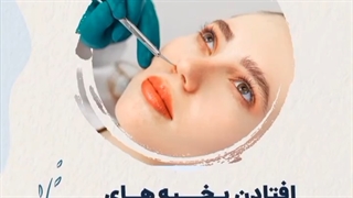 افتادن بخیه