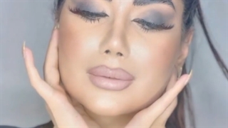 بینی نیمه فانتزی زیباجوی عزیزمون حدود ٤ سال بعد عمل .