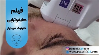 هایفوتراپی در کلینیک تخصصی پوست و مو سینایار اصفهان درمان جای جوش