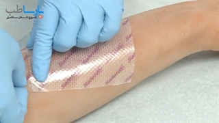 پانسمان فوم سیلیکونی مپیلکس ساده و نقره مونلیکه