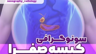 سونوگرافی کیسه صفرا