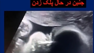 تصویر سه بعدی خیلی کمیاب از جنینی با چشمان باز