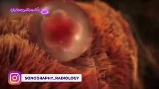 بچه توی شکم مامانش دقیقا در چه حاله؟