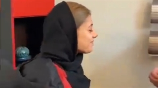 هشت روز بعد از جراحی بینی