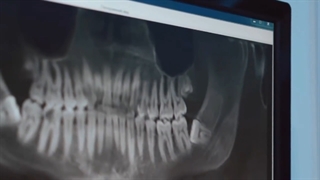 هر آنچه در مورد خر و پف باید بدانیم