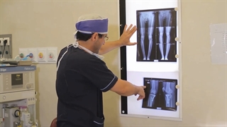 عمل جراحی اصلاح زانوی پرانتزی