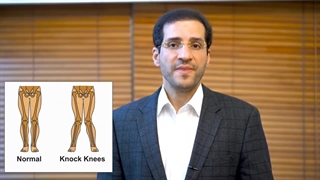 زانوی ضربدری