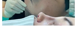 جراحی زیبایی بینی مراجعه کننده محترم مطب