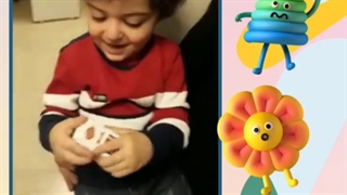 محمد حسن کوچولو خوشگل بعد از اتمام کار ترمیم دندان