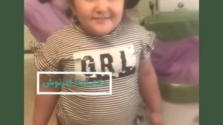 دختر با نمک ما بعد از ترمیم دندان