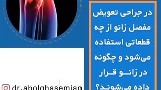 در جراحی تعویض مفصل زانو از چه قطعاتی استفاده می‌شود و چگونه در زانـــو قــرار داده می‌شونـد؟