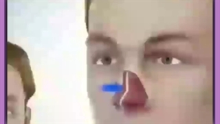 جراحی سپتوم