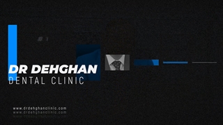 کلینیک ایمپلنت دندان : مراحل قالبگیری ایمپلنت