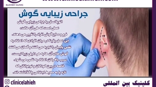 اتوپلاستی