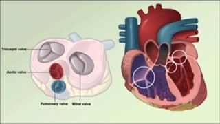 بیماری دریچه ای قلب