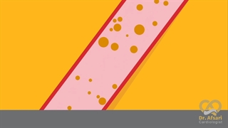 نقش استاتین ها در کاهش کلسترول