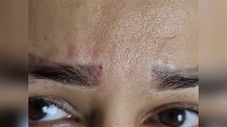 ریمو تخصصی تاتو در رشت