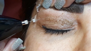 پلکسر پشت پلک