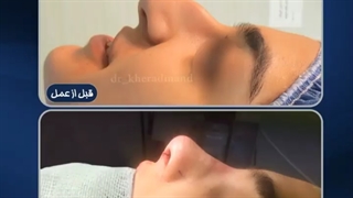قبل و بعد جراحی