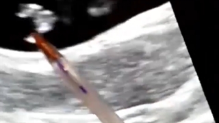 رویان ۸ هفته