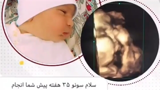 سونو ٣٥ هفته و بعد از زایمان