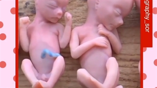 مراحل رشد جنین