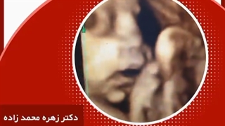 سونوگرافی ۴بعدی